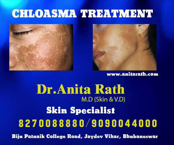 best skin treatment clinic in bhubaneswar near kar clinic